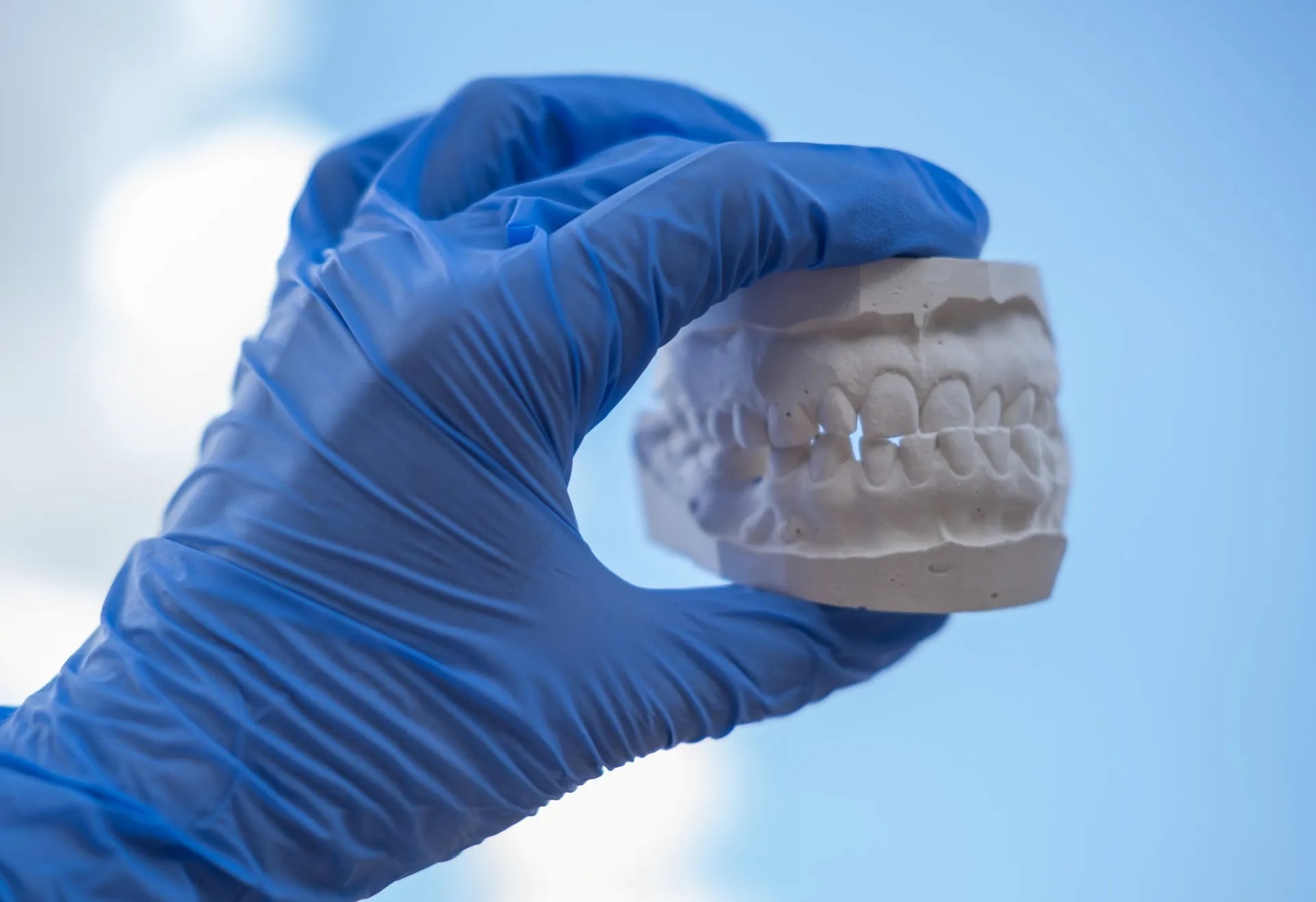 Dentures — our approach