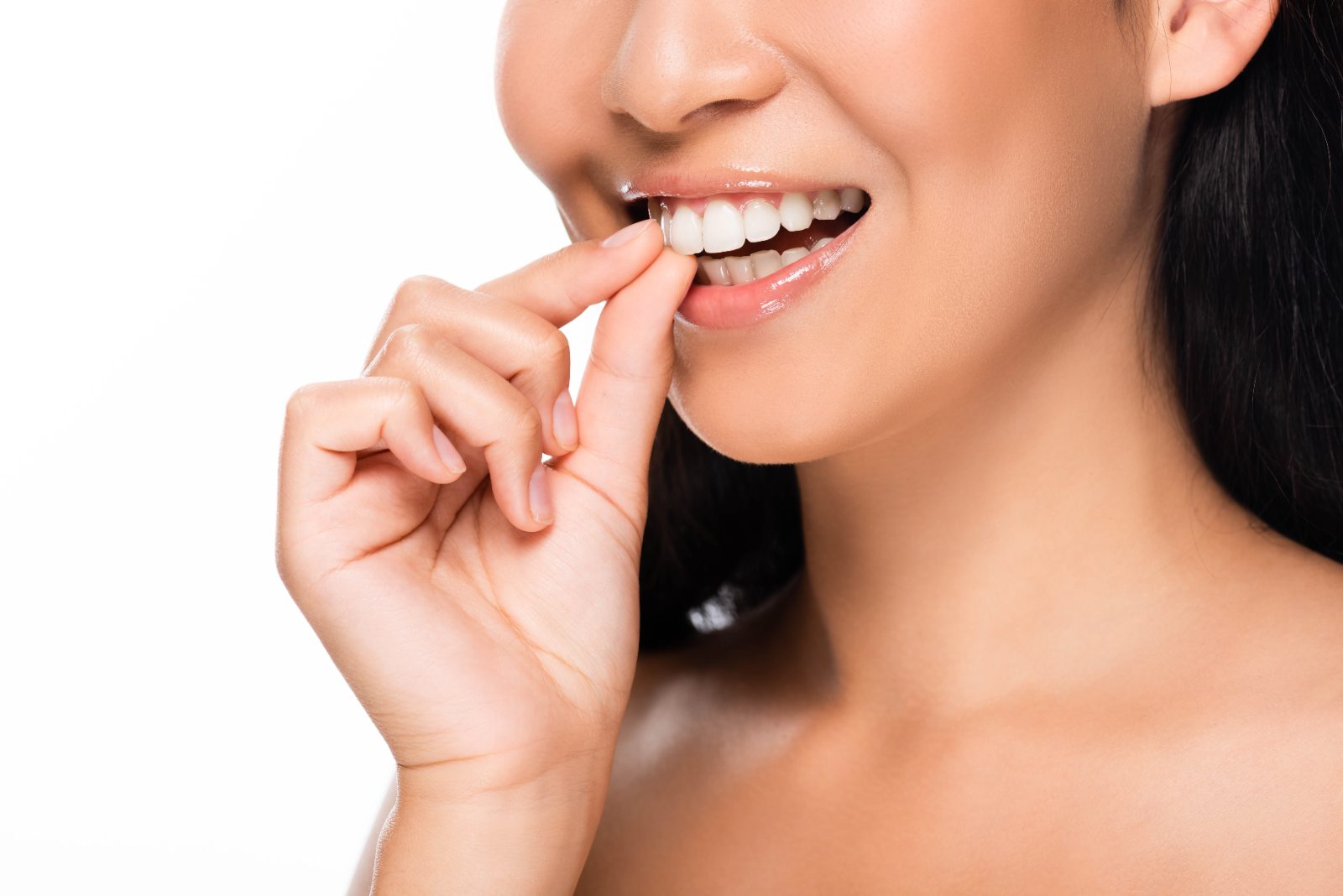 A close-up smile after porcelain veneers